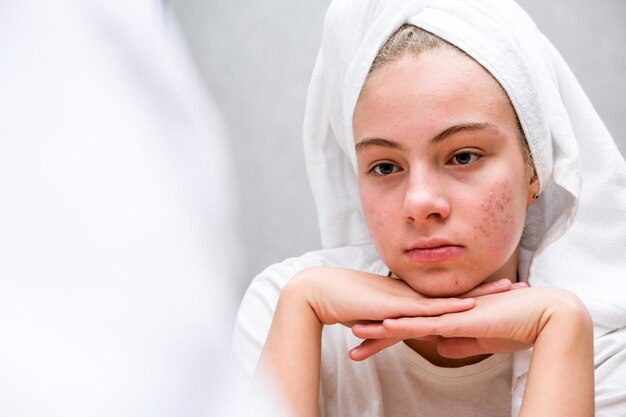 Очищення підліткової шкіри: як вибрати засіб для вмивання